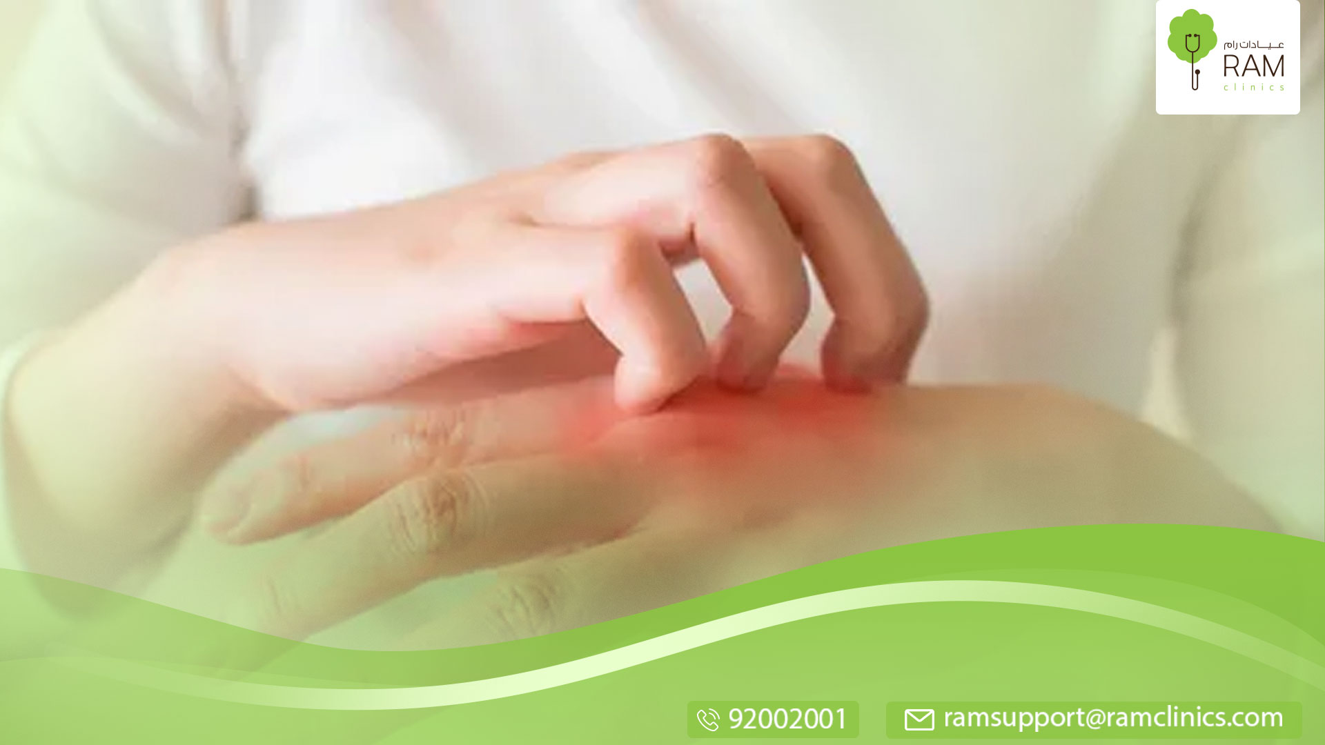 فطريات الجلد