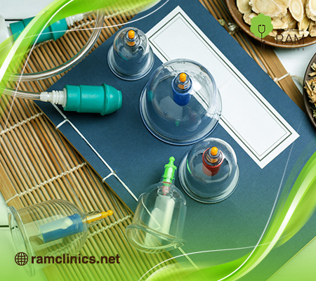 فوائد الحجامة