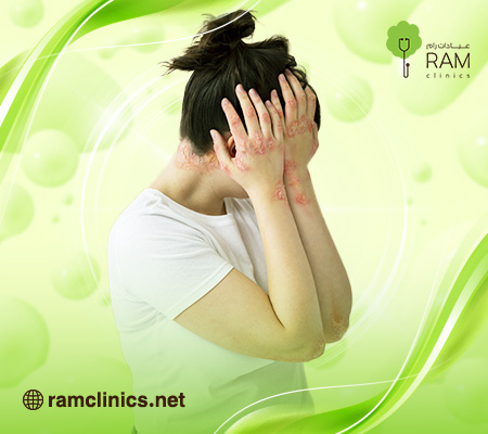 مرض الزهري للنساء