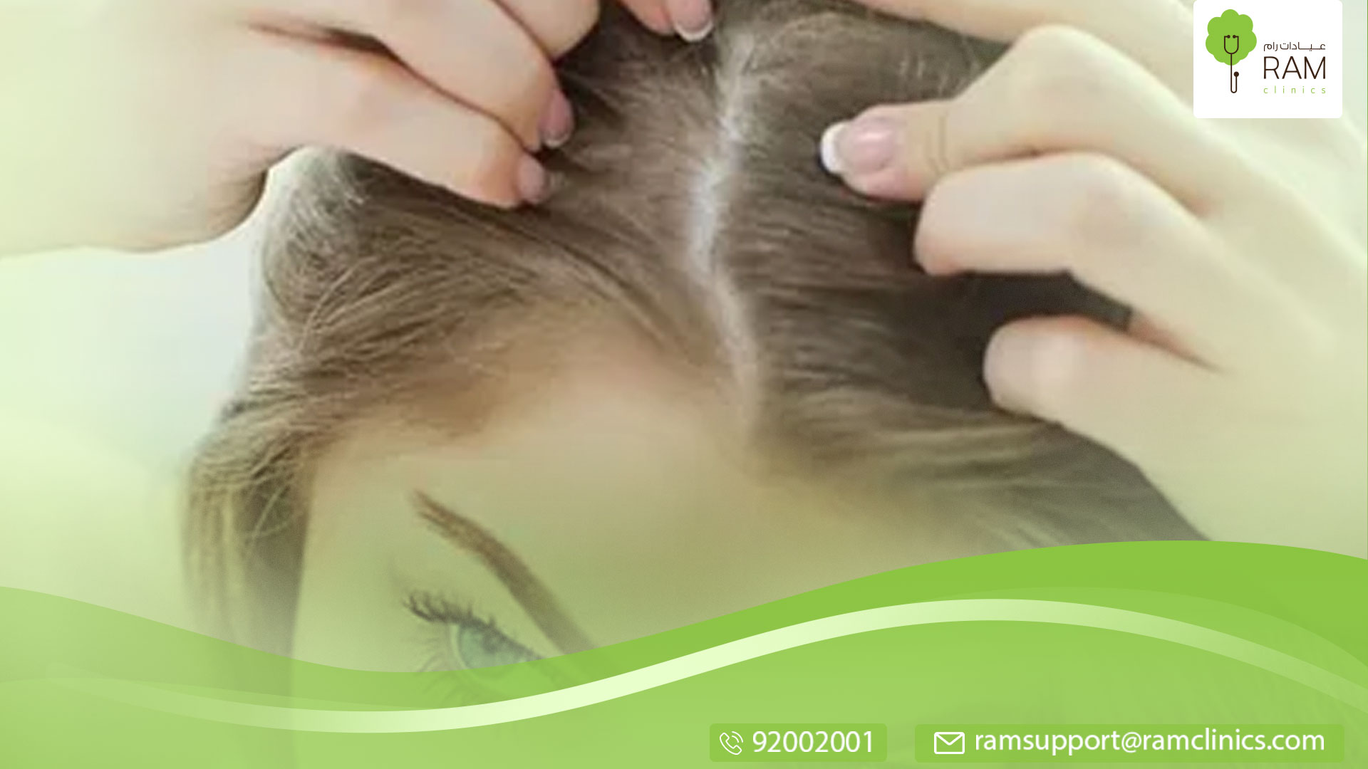 اسباب اكزيما الشعر