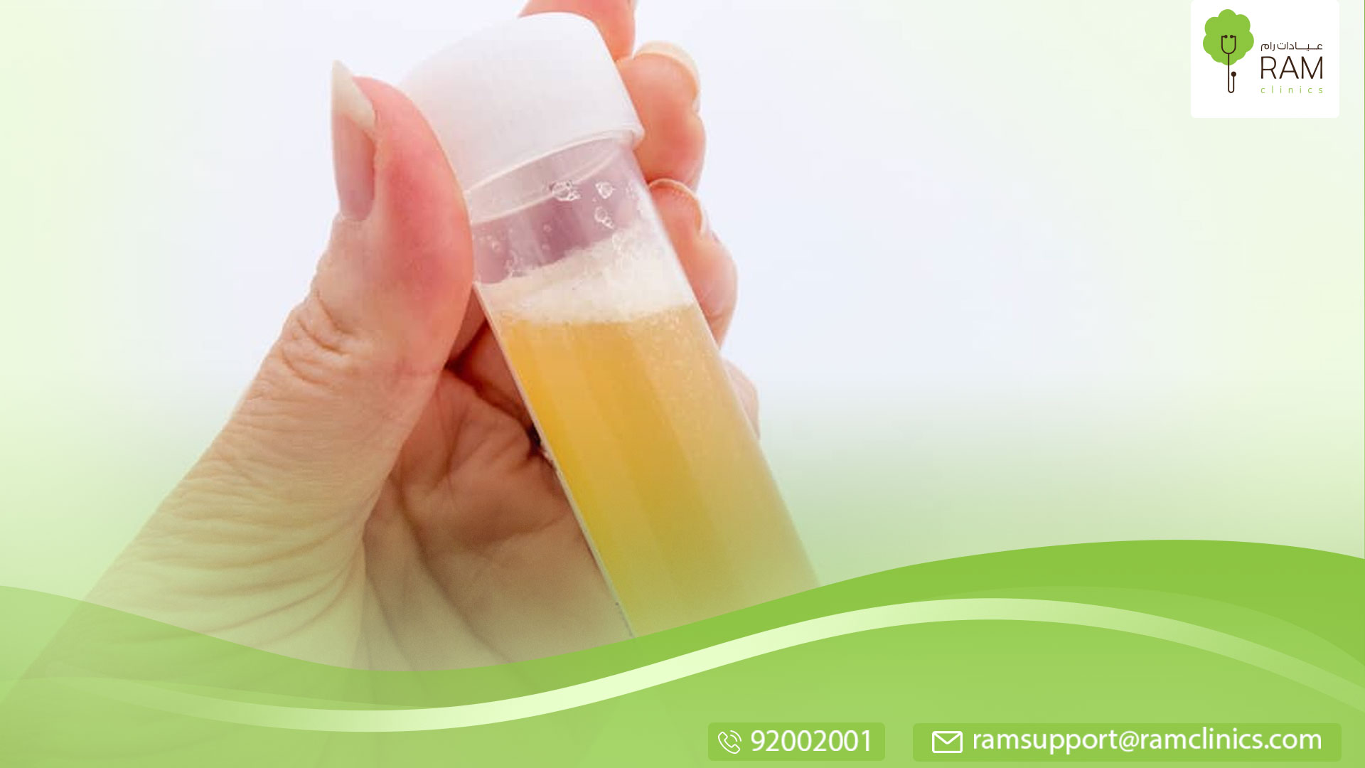 ما هو الفلور