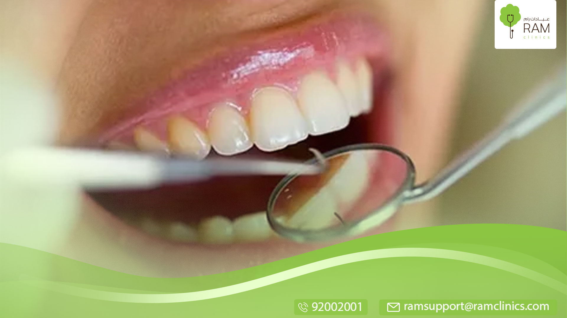 الأسنان الحساسة