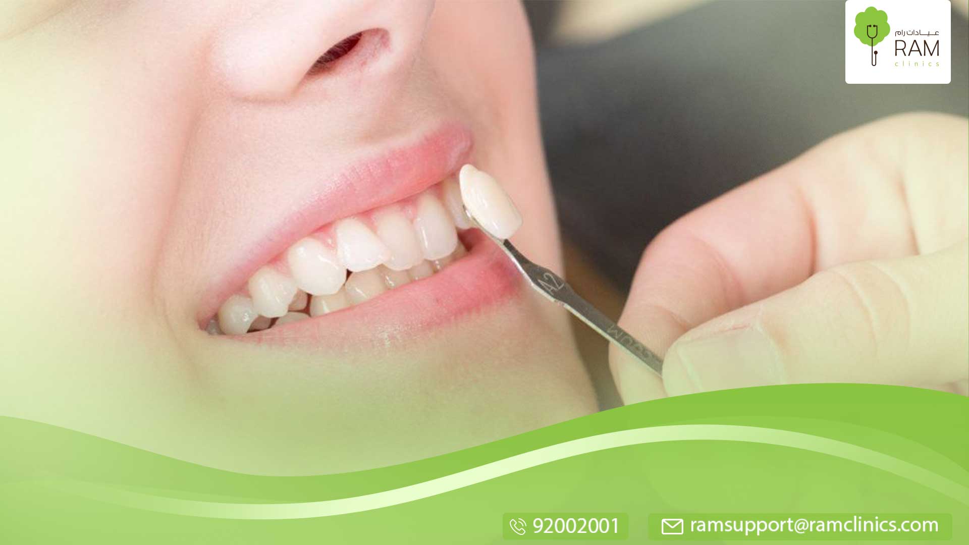 العدسات اللاصقة للأسنان