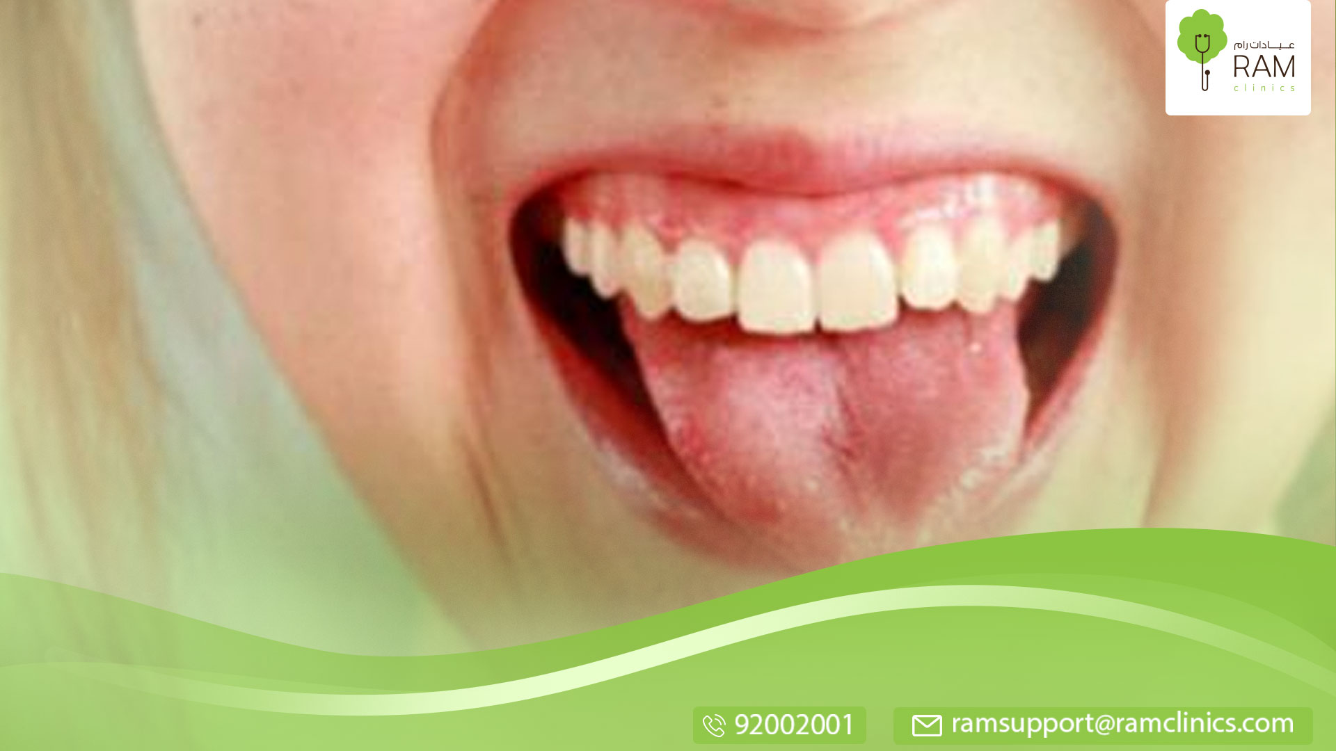 المرارة في الفم