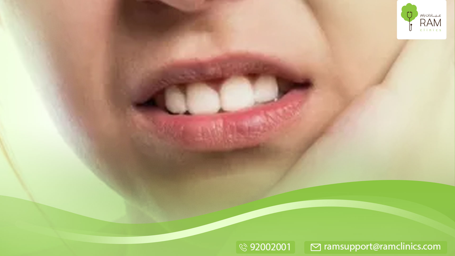 يجب اقتلاع الضرس