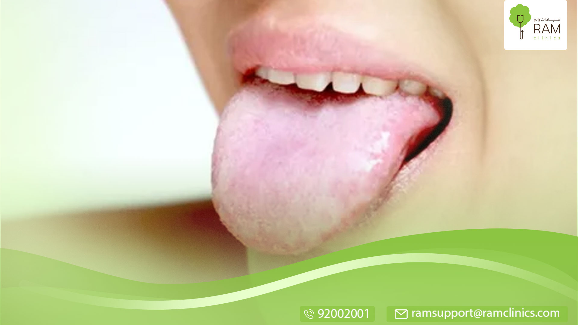 علاج فطريات