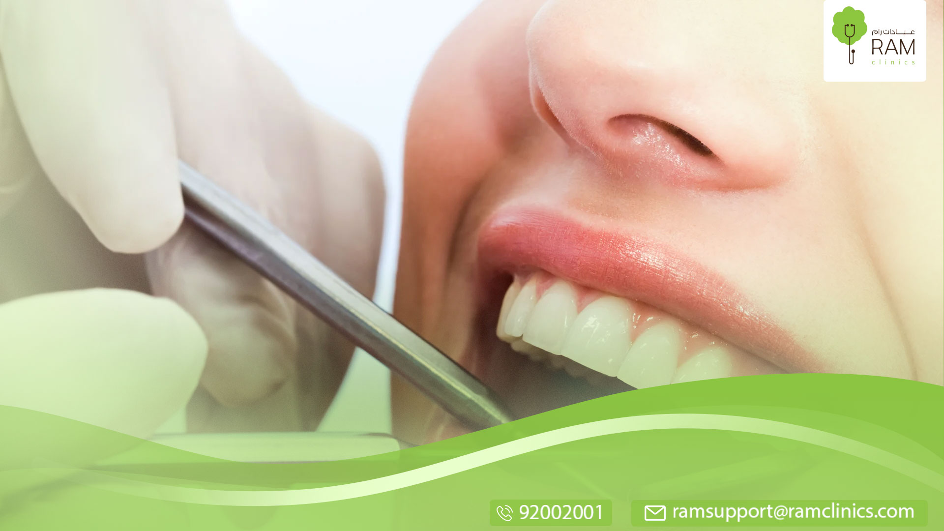 ازدحام الأسنان