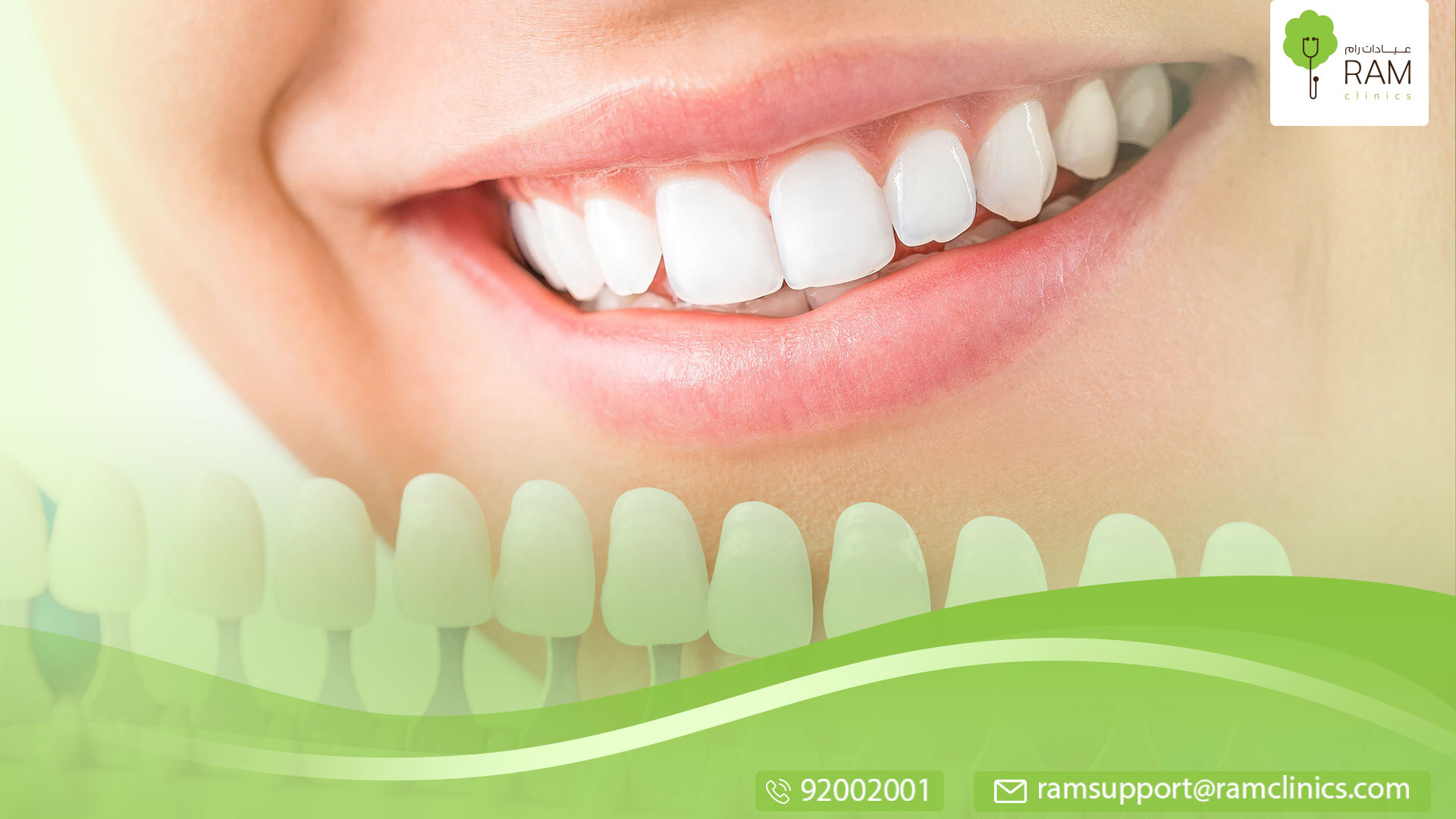 حشوات الأسنان