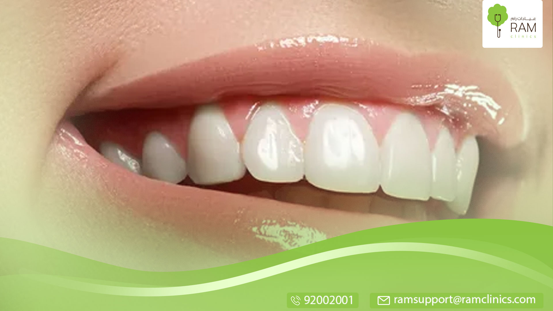 واقي الأسنان الليلي