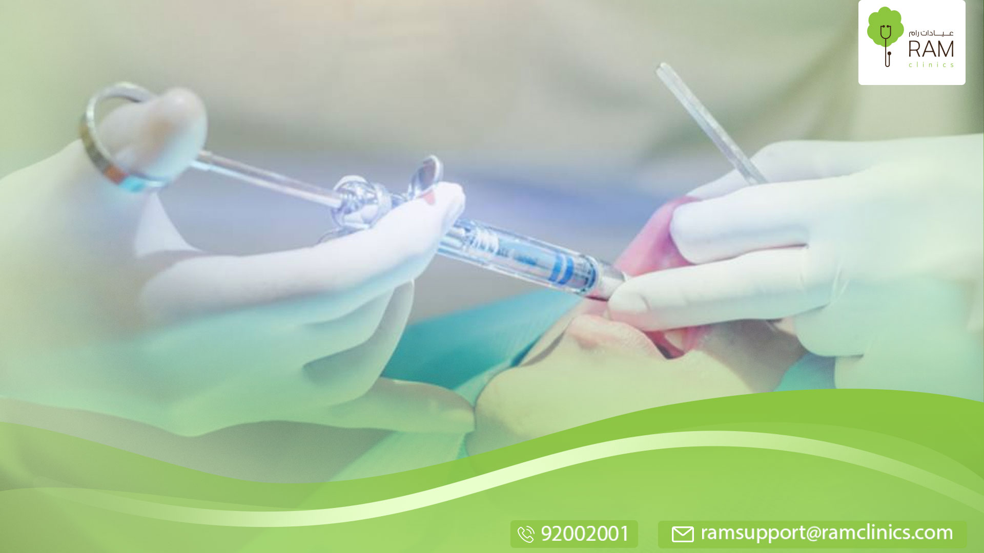 بعد اقتلع ضرس العقل