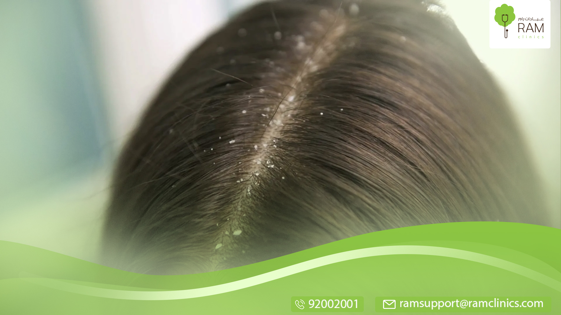 للقمل والصئبان