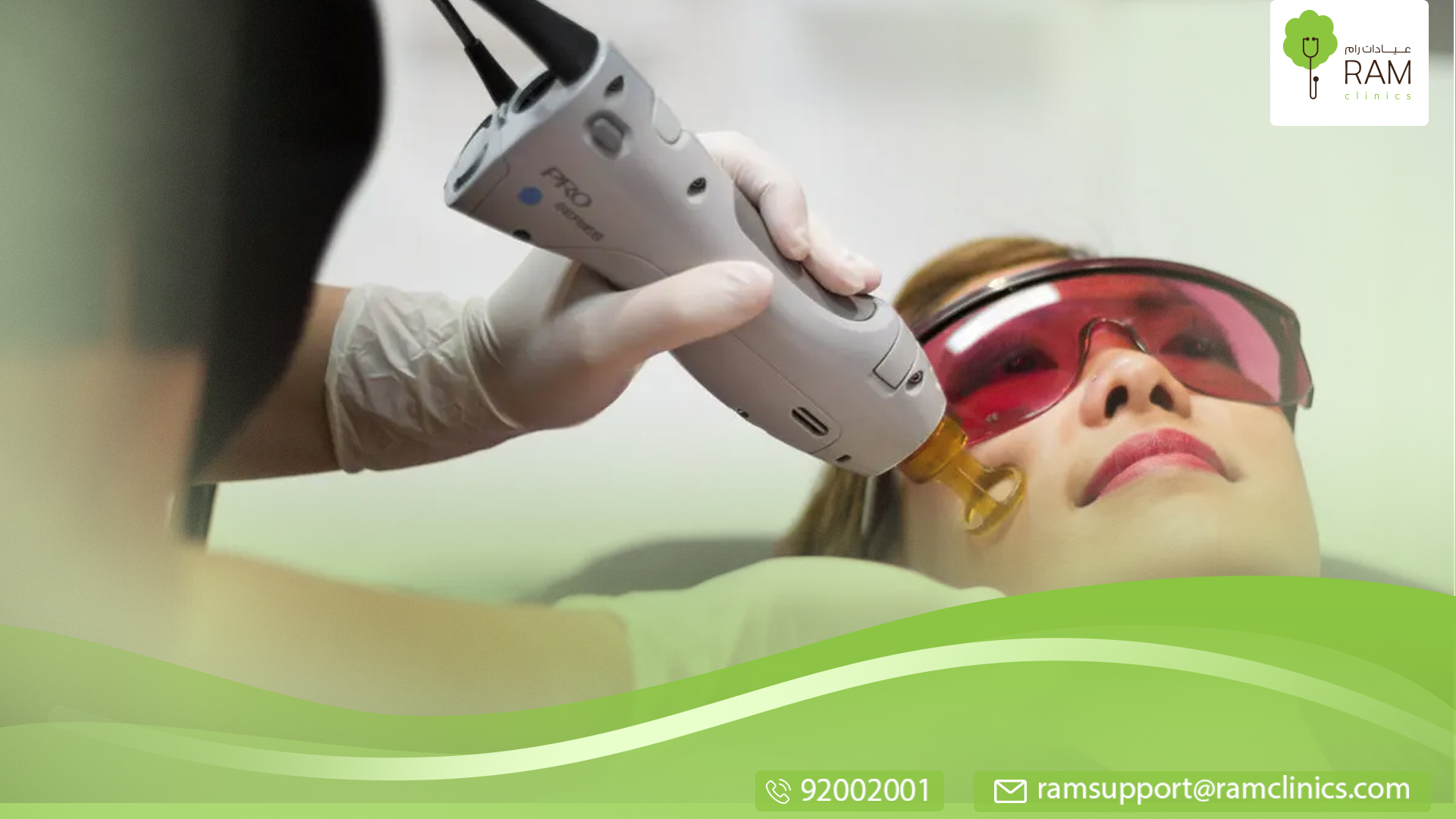 الليزر الكربون