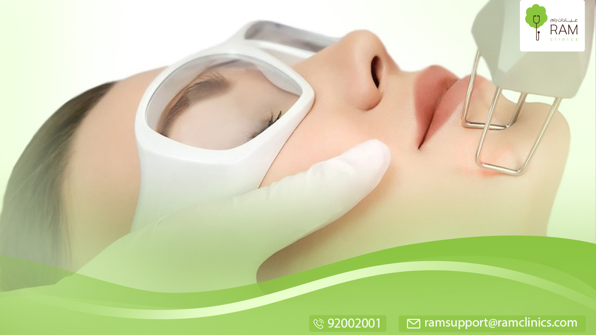 حروق الليزر