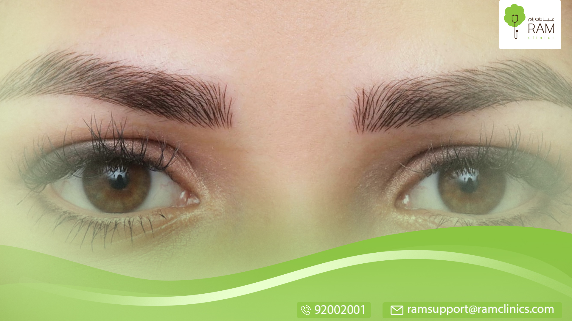 تكثيف الحواجب