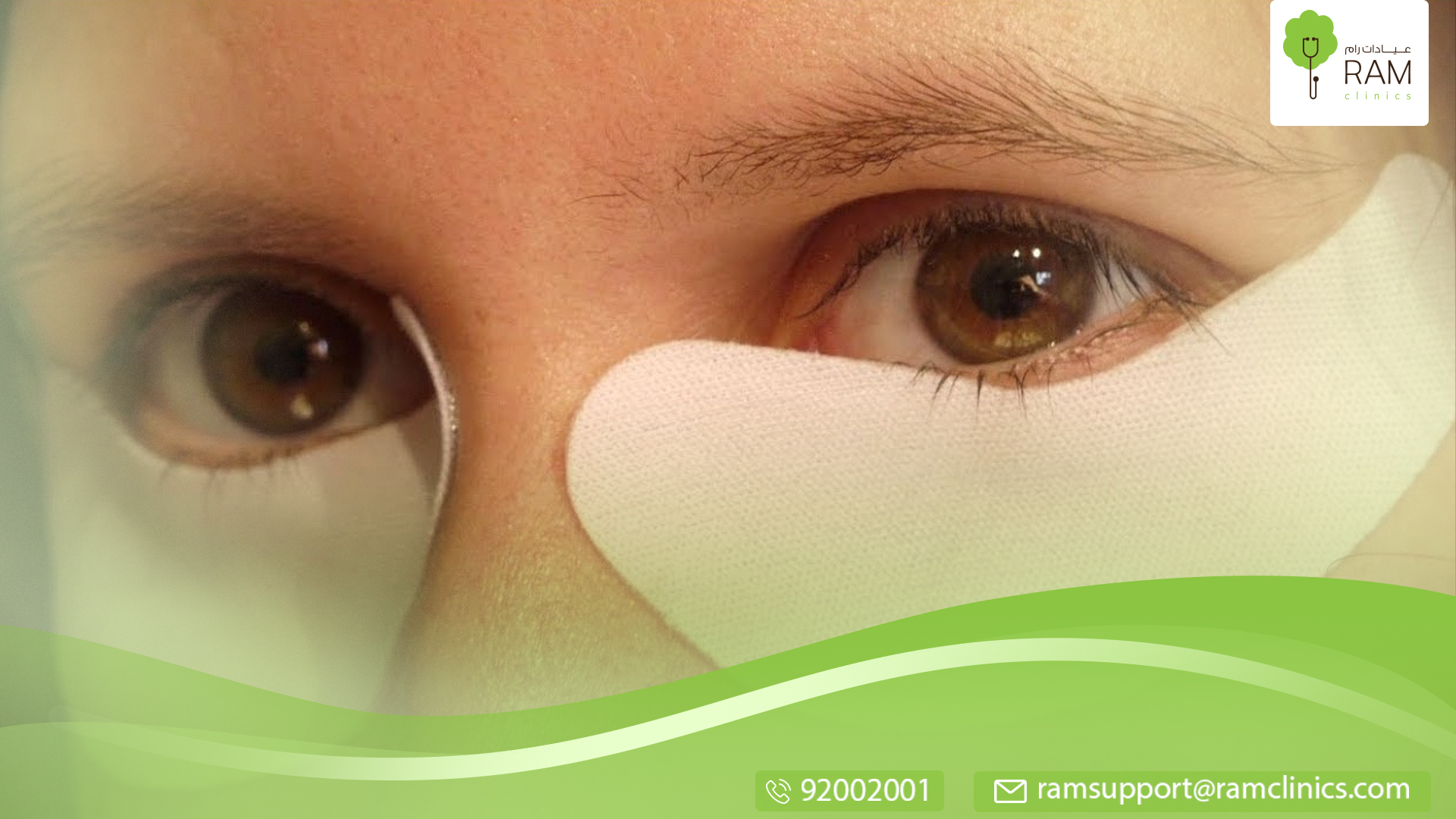 نتفاخ عروق الجبهة