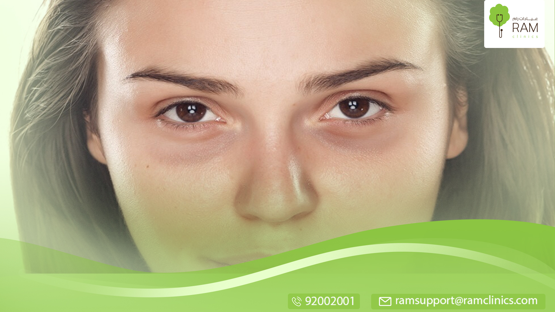 بازالة البقع السوداء