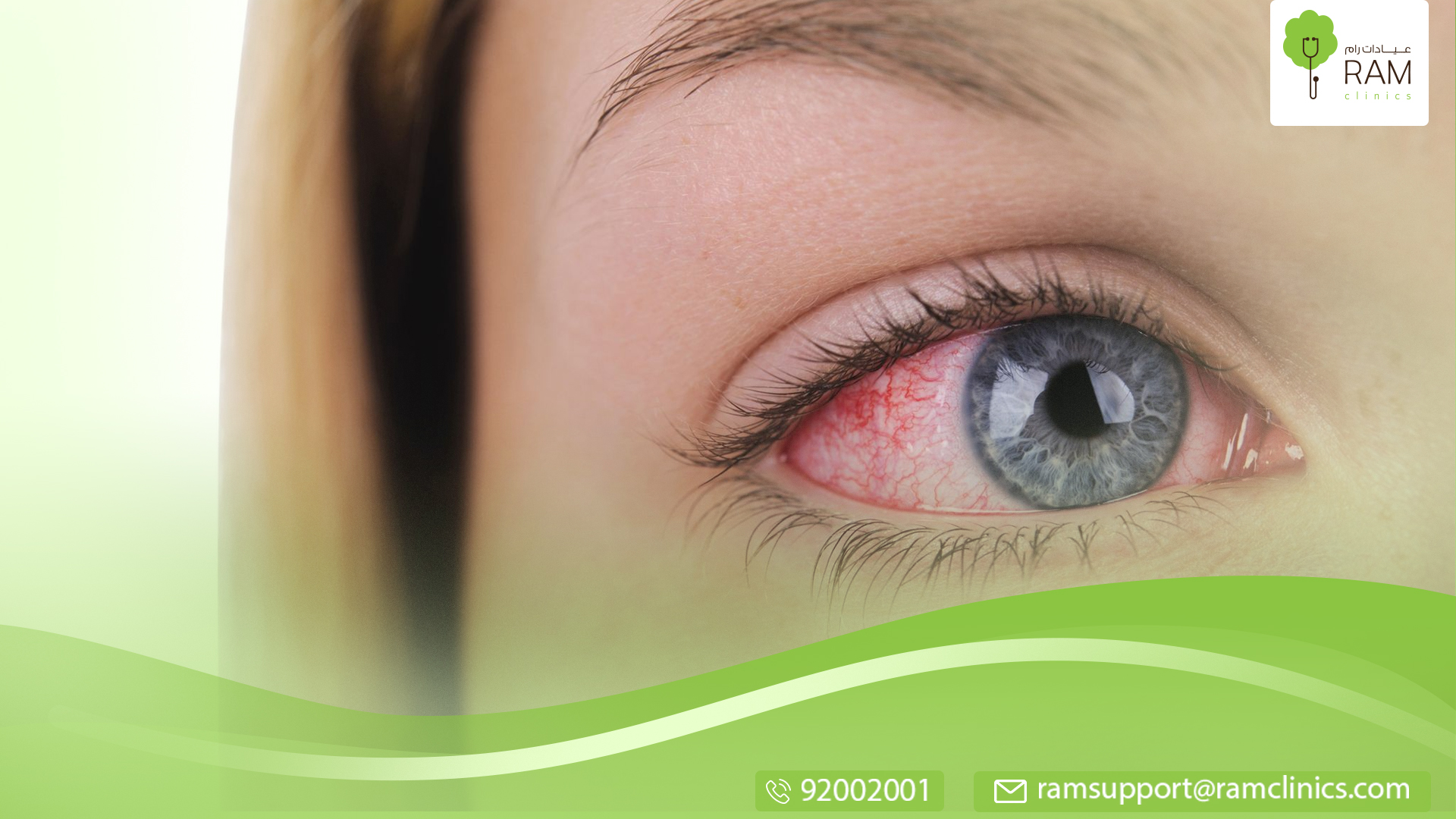 احمرار العين بعد الاستحمام