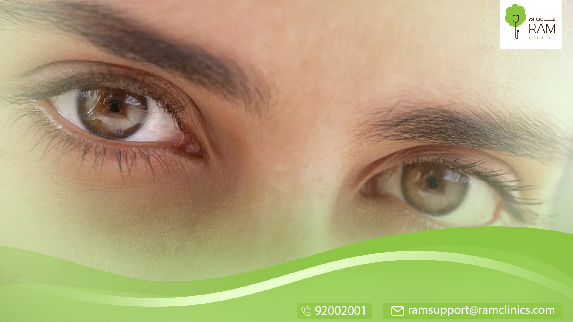 أسباب اللطخة الصفراء في العين