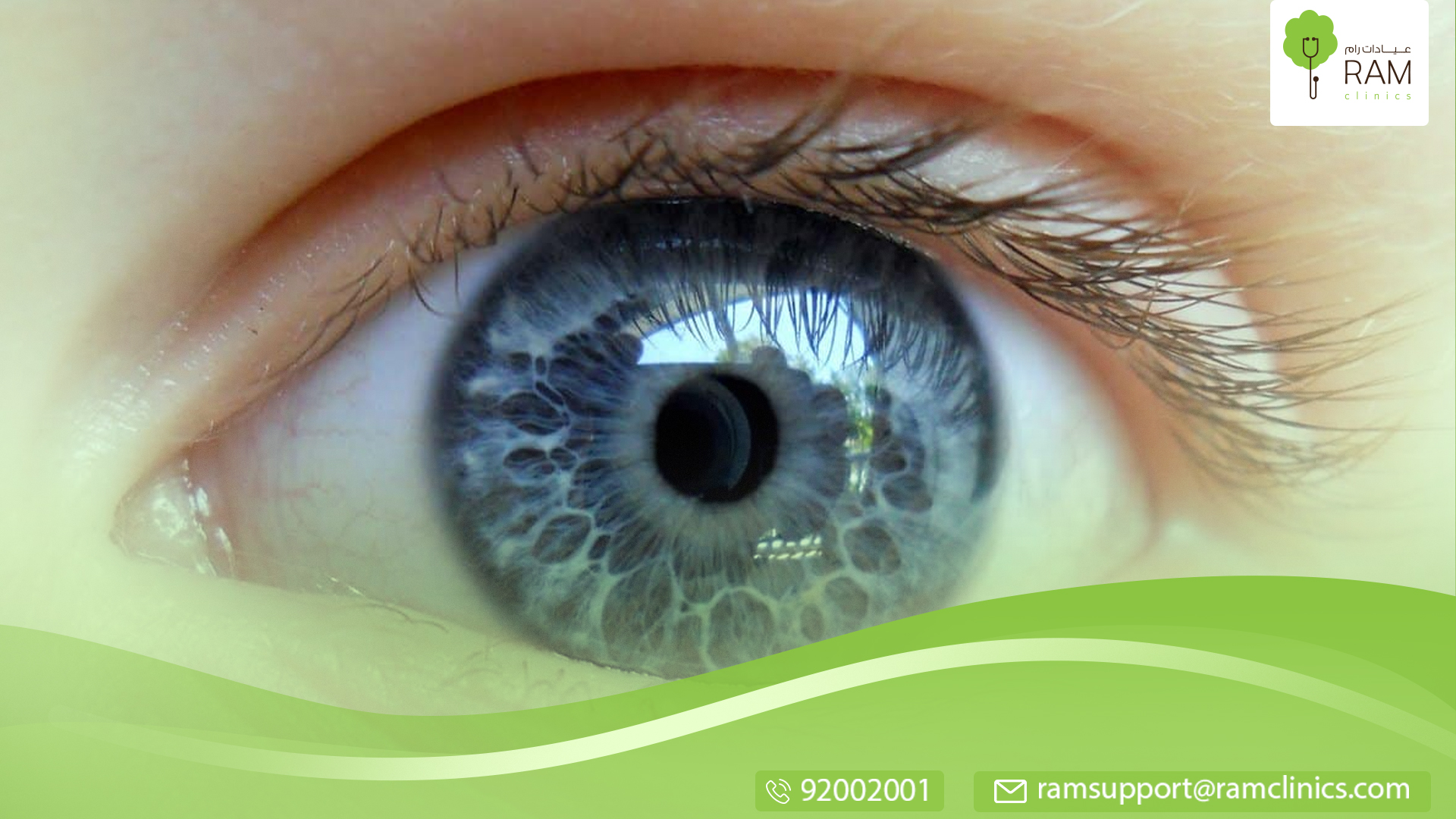 العدسات اللاصقة