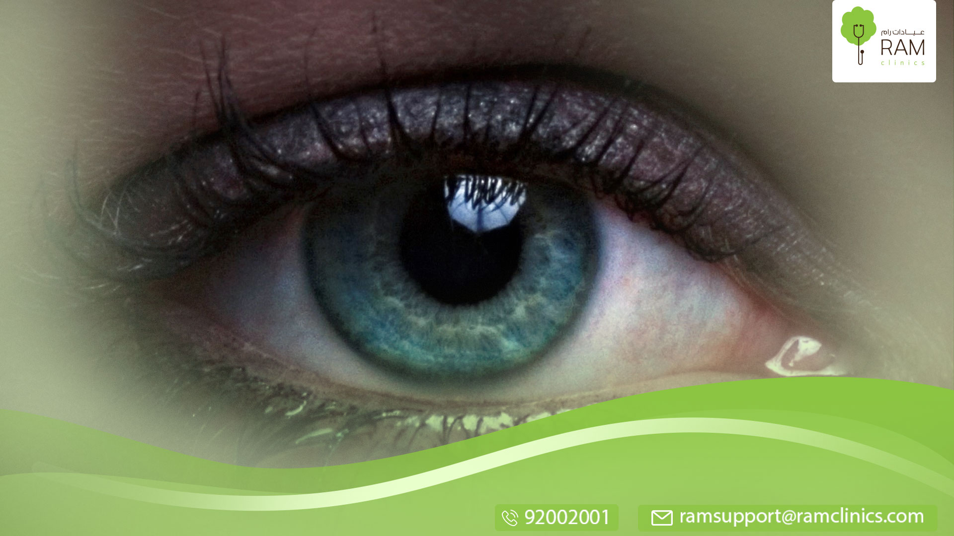 دموع العين المستمرة