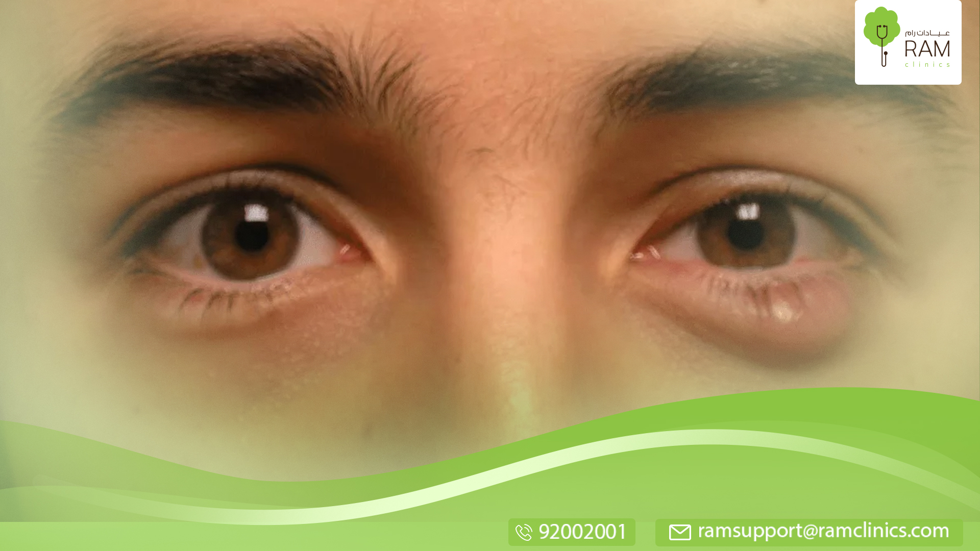 أسباب حبوب العين