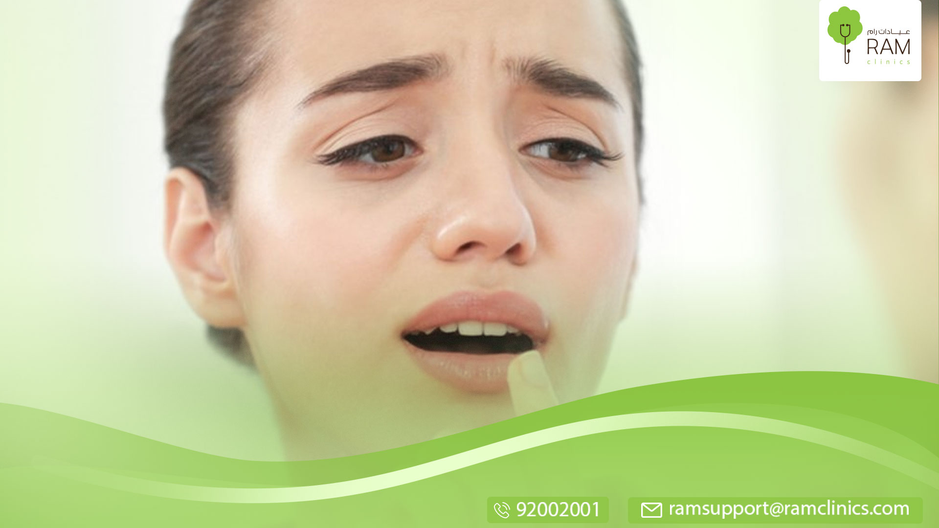 تنميل اللسان