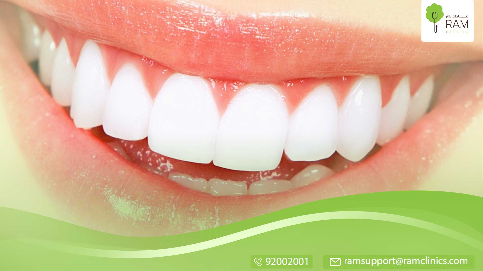 عملية قص اللثة