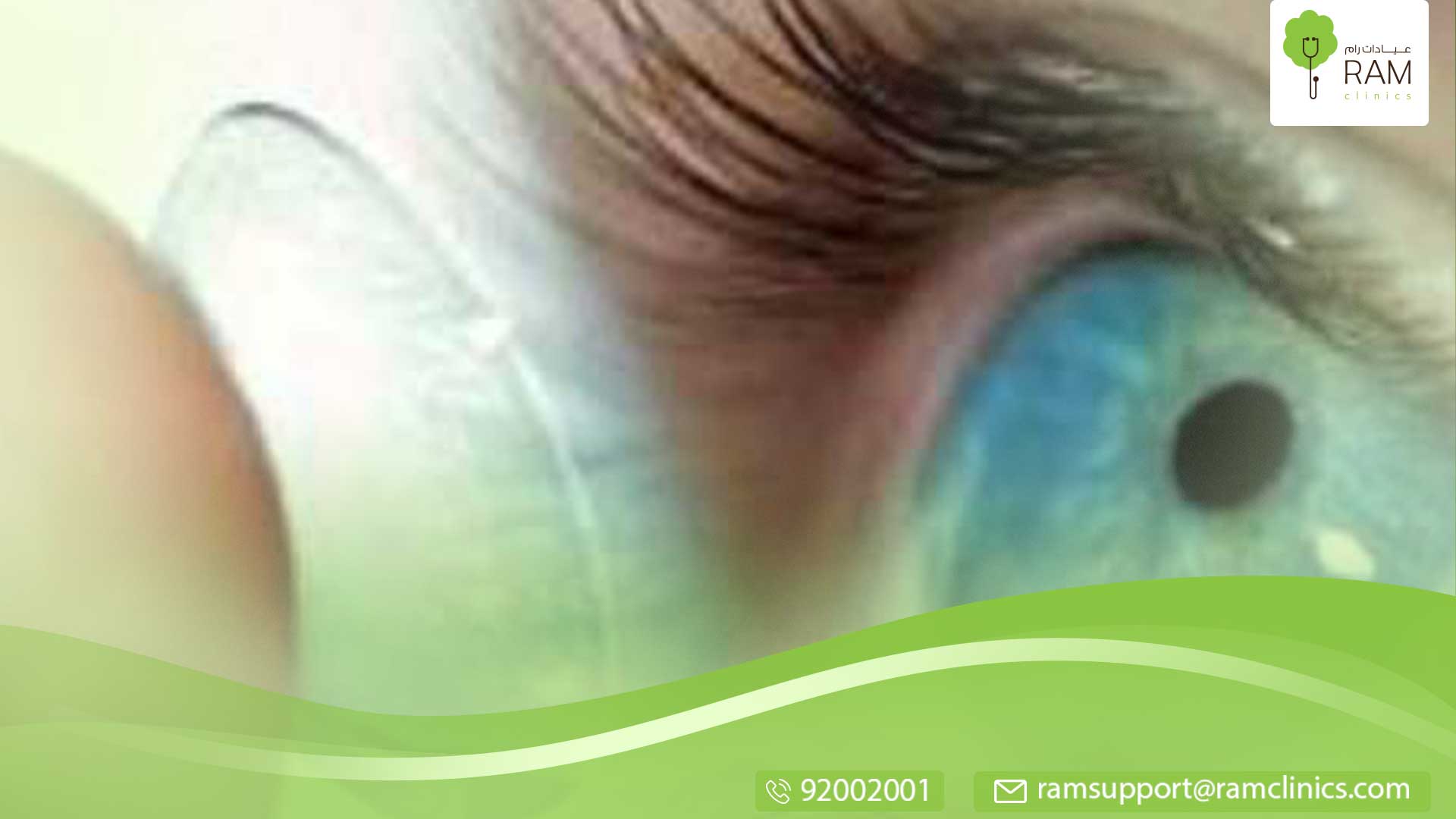 ماهي استخدام العدسات اللاصقة