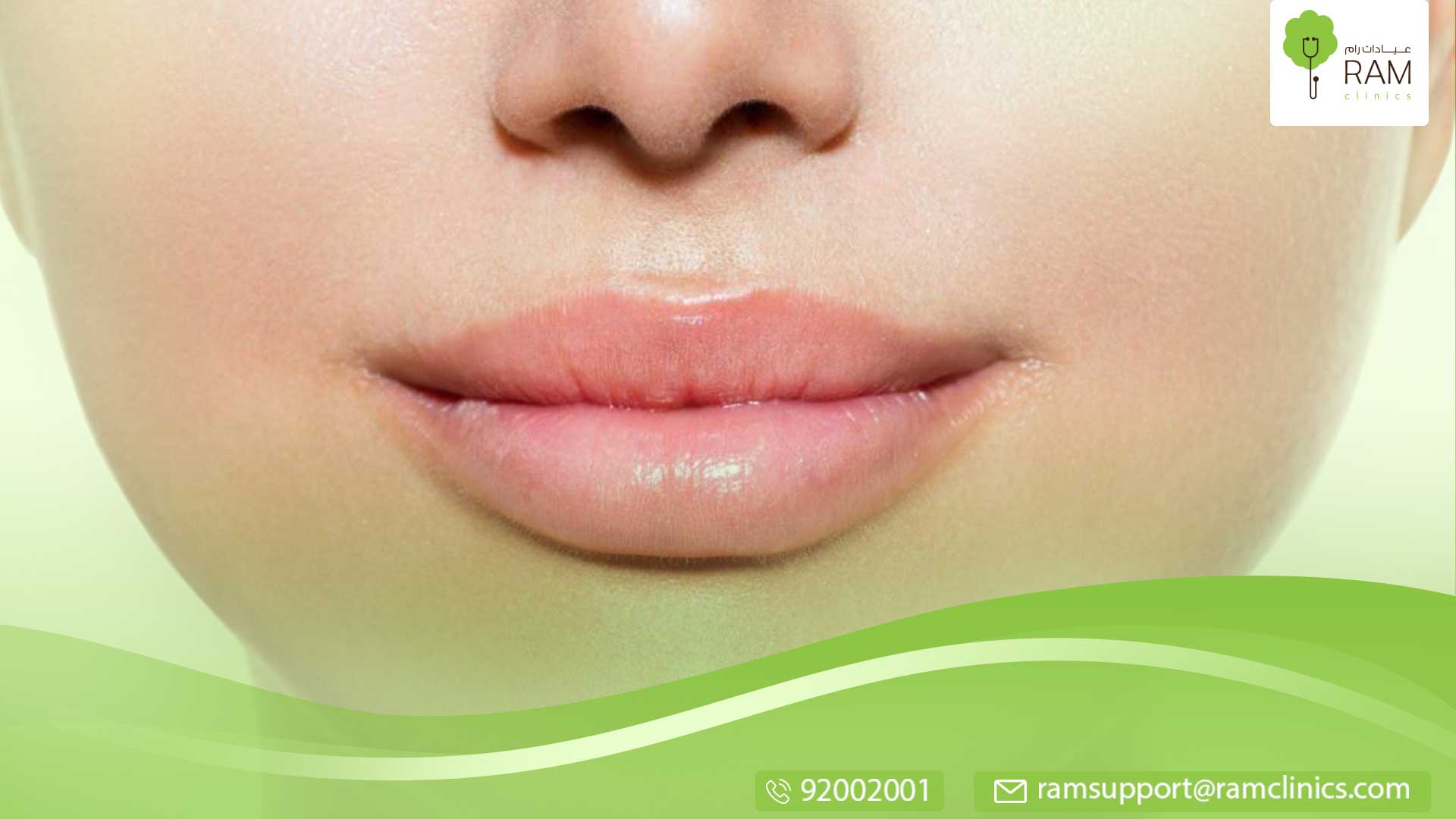 تكتل الفيلر