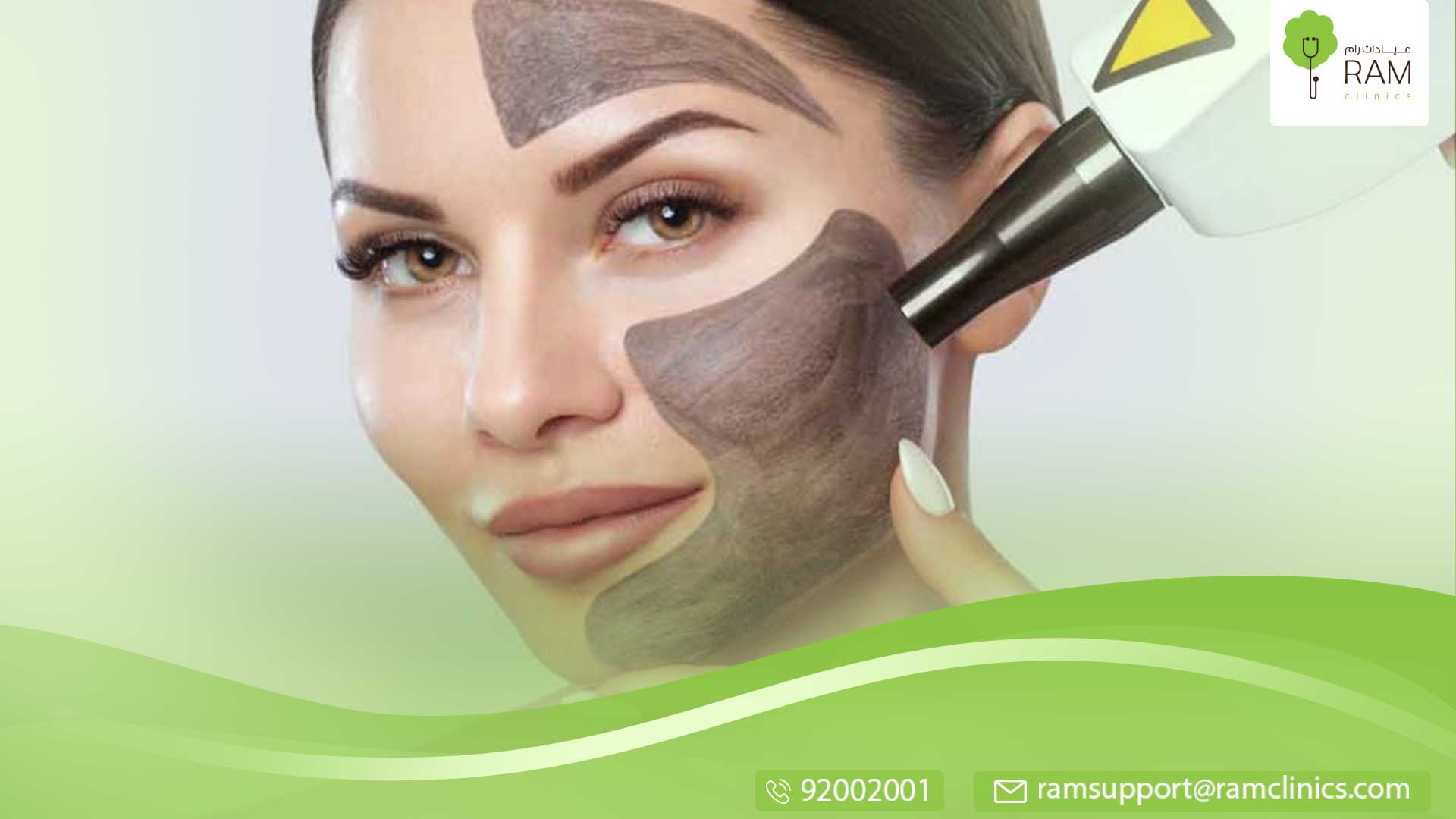 الليزر الكربوني