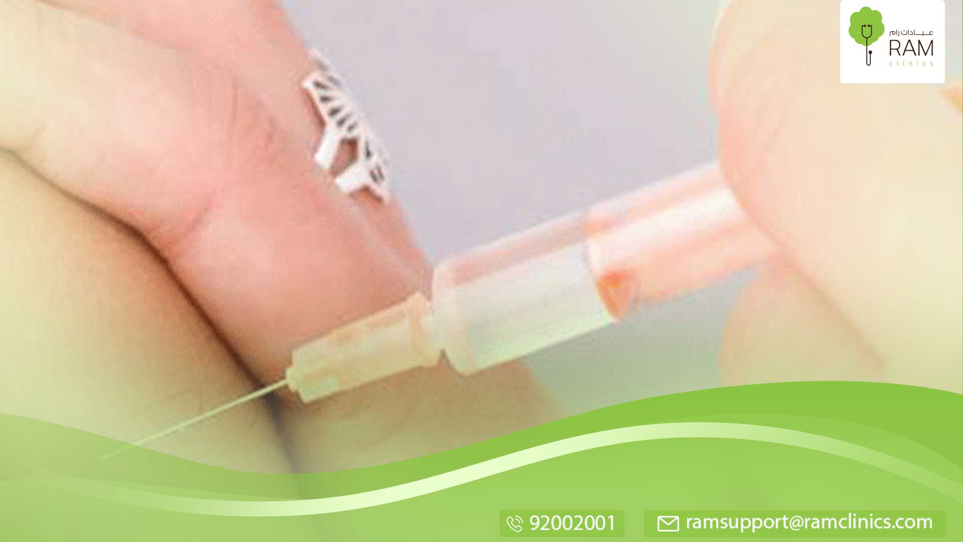 حقن بلازما الصفائح الدموية