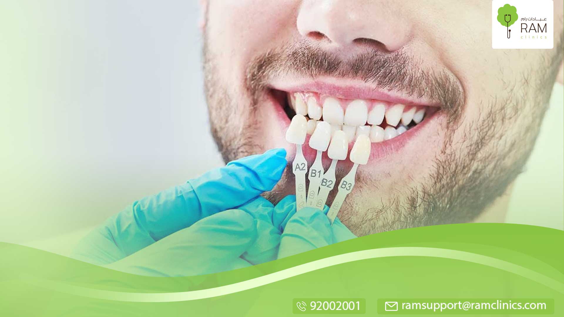 تلبيسات اسنان