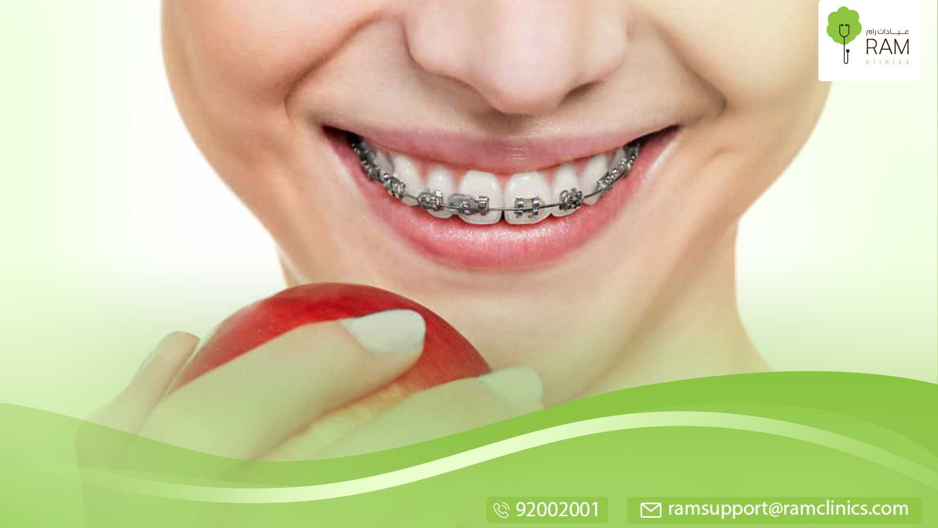 قلع الأسنان