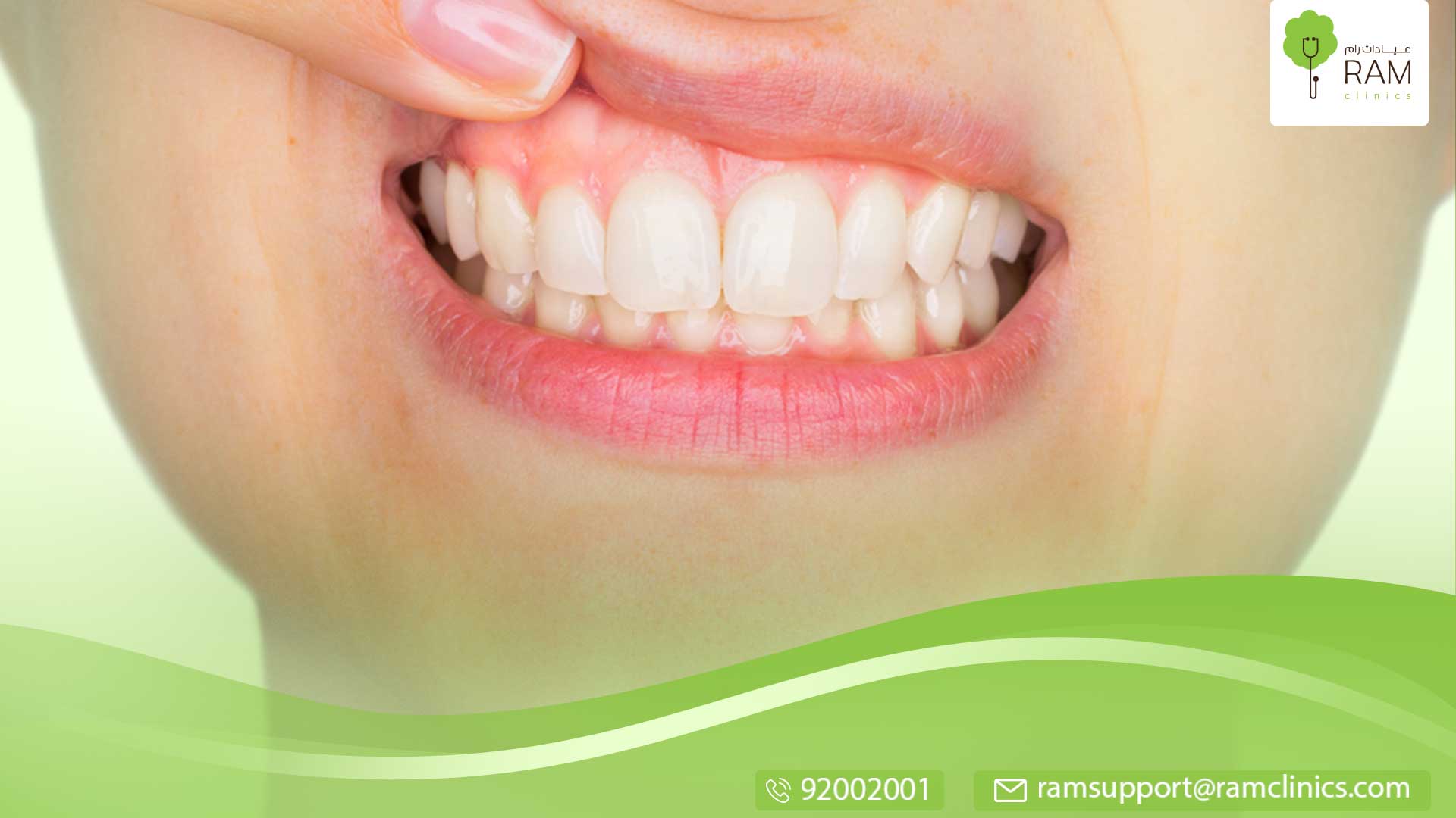 التهاب اللب