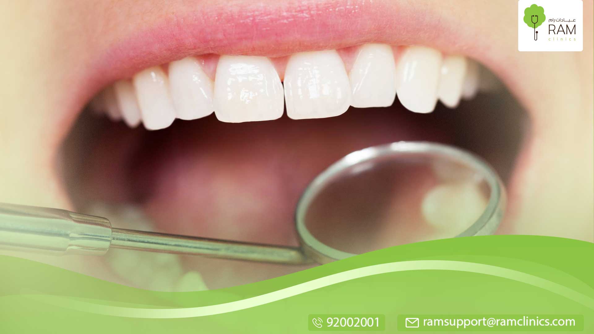 عملية خلع الأسنان