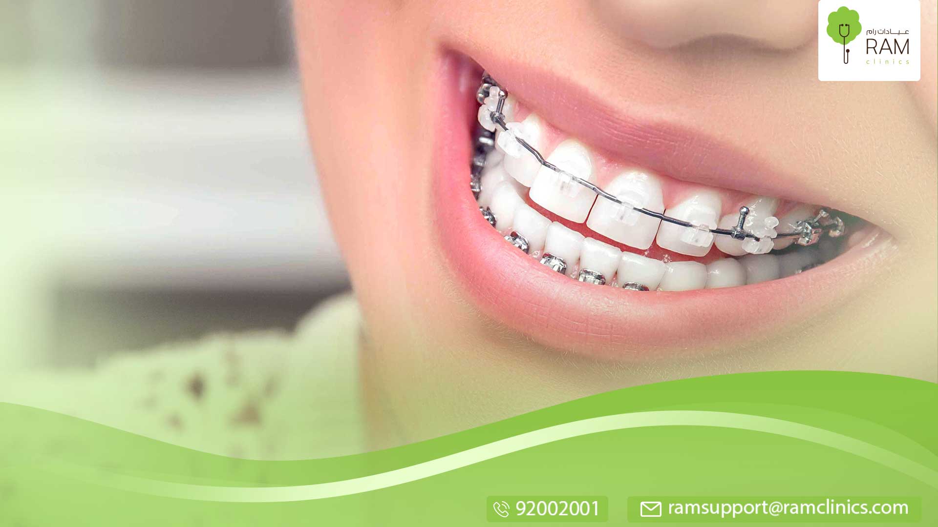 سن تقويم الأسنان