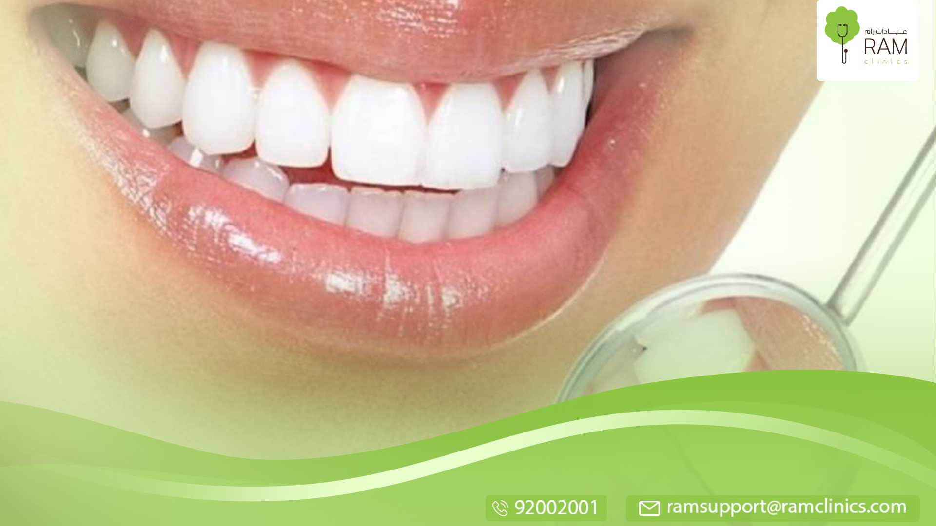 جسر الأسنان الثابت