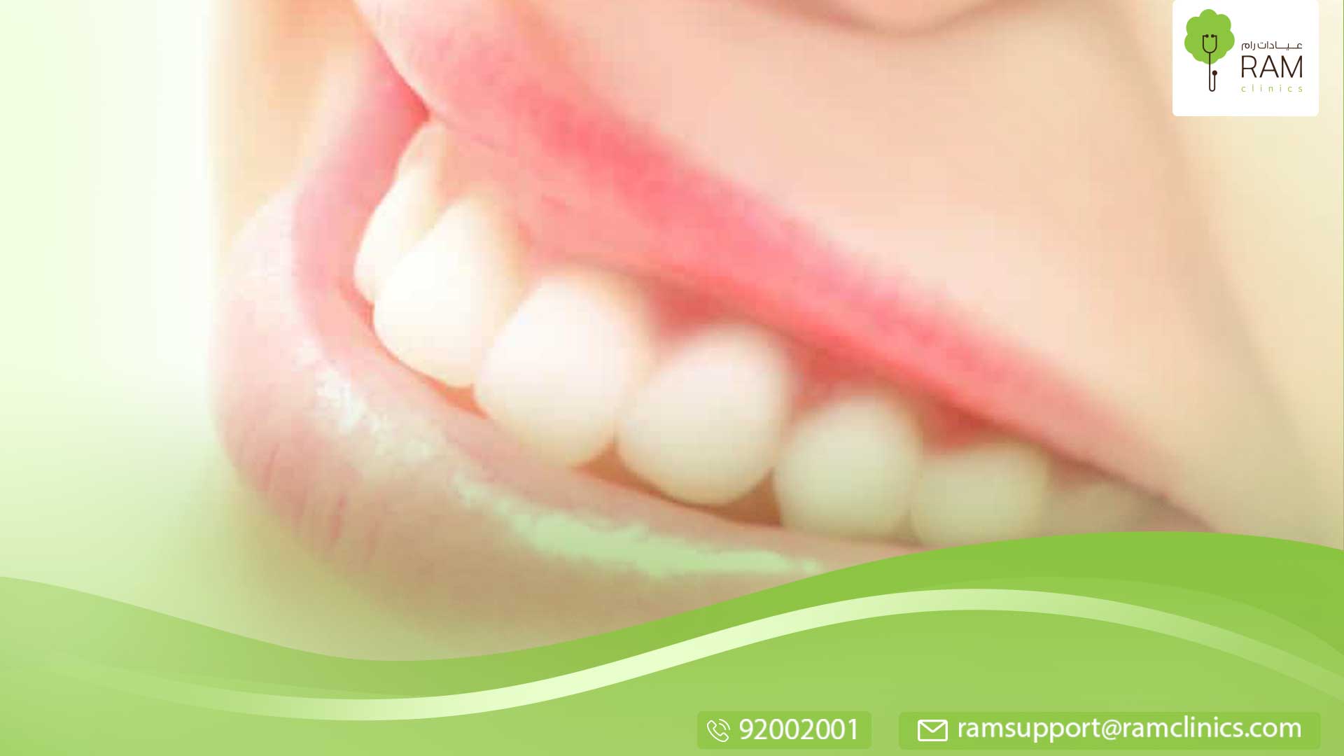 طريقة لتبييض الاسنان