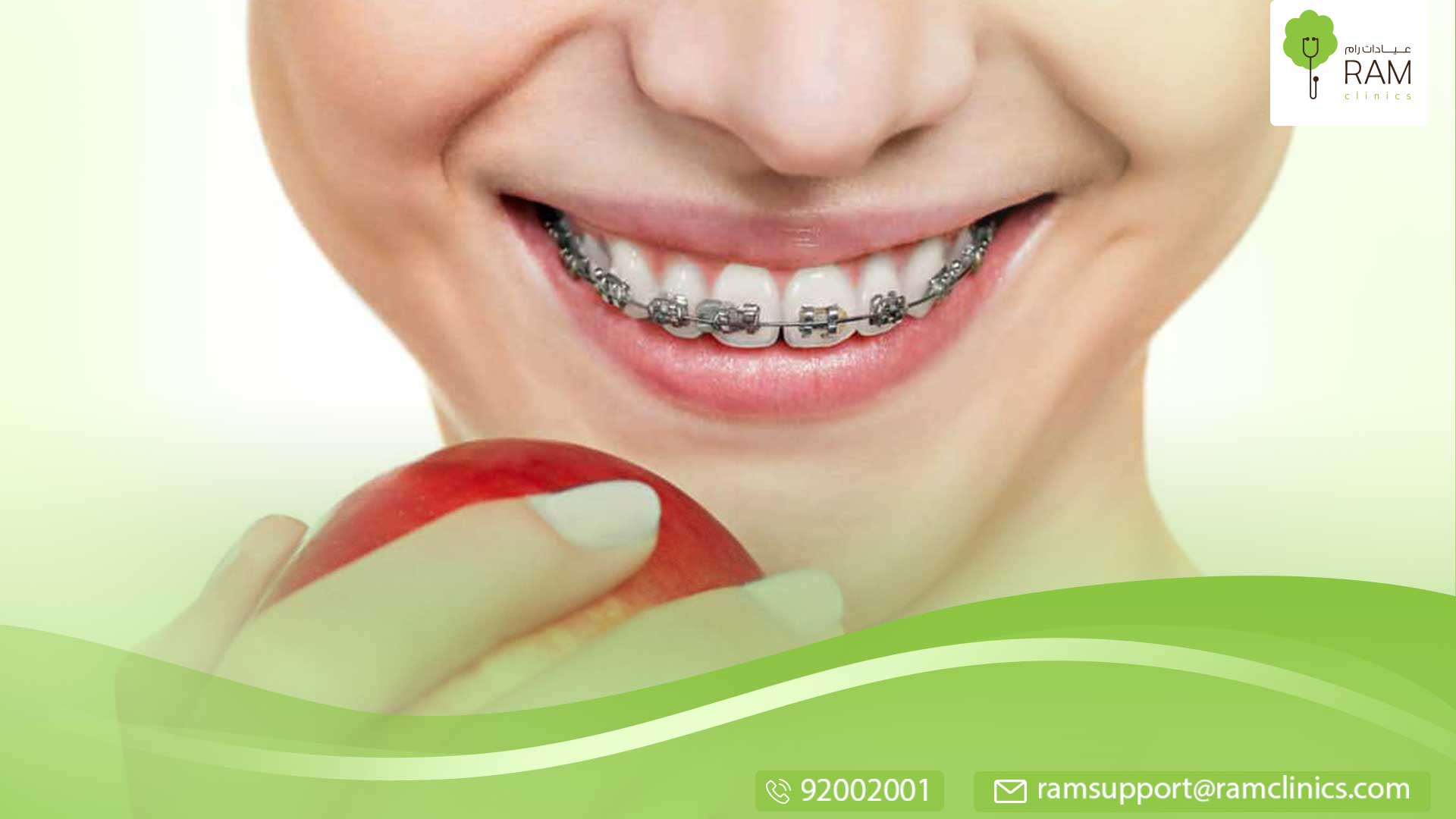 الفينير ورائحة الفم