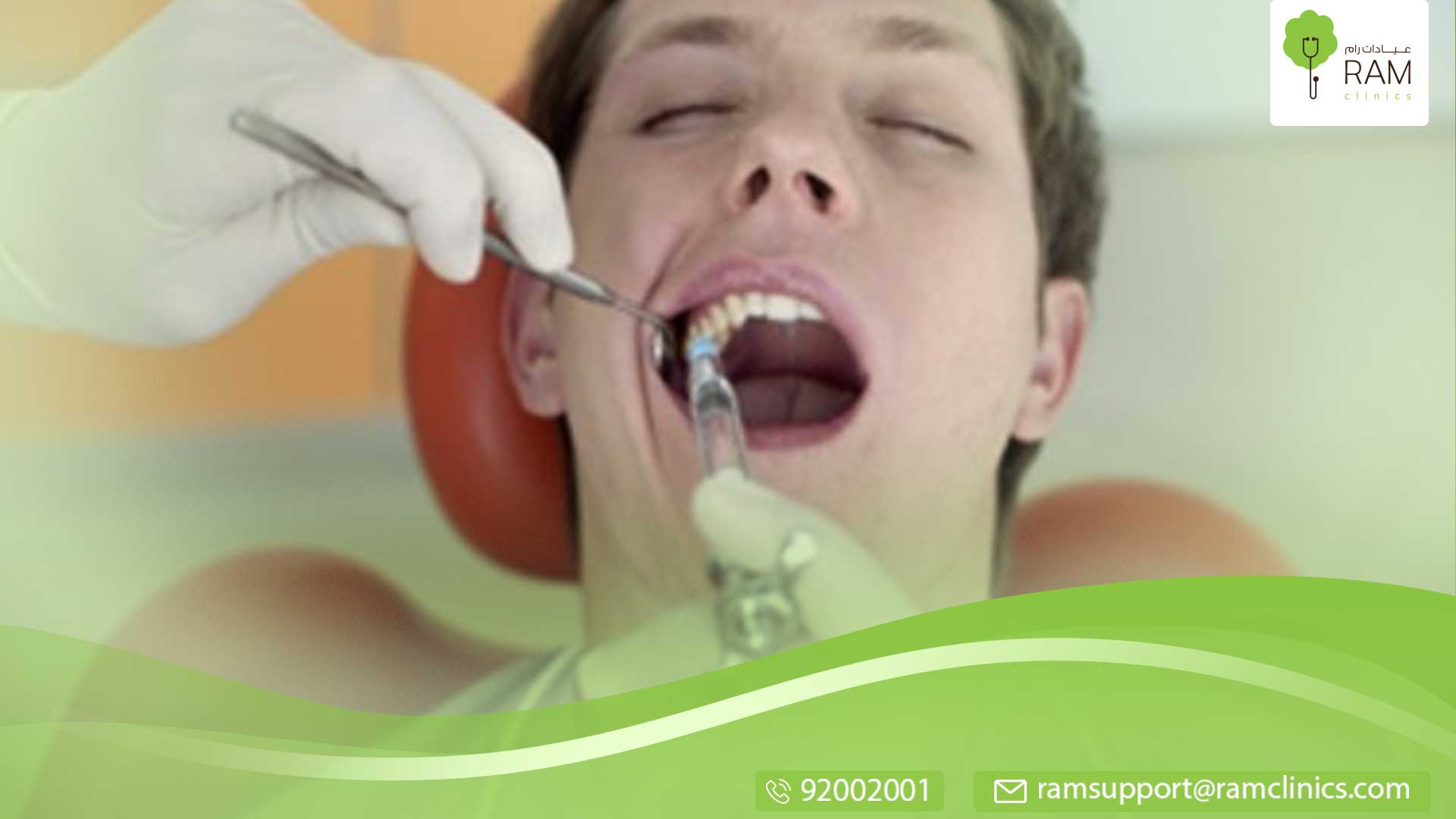 قلع ضرس العقل