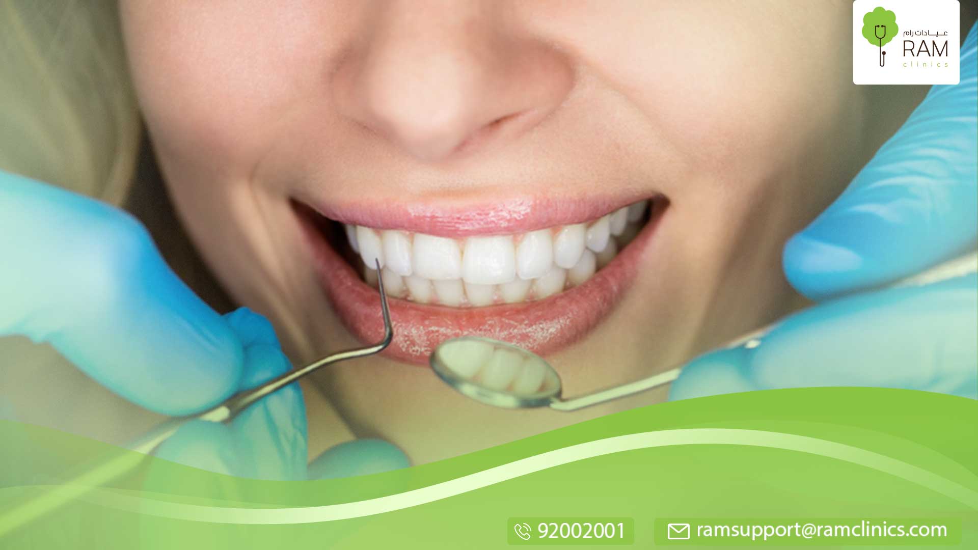 تيجان الأسنان