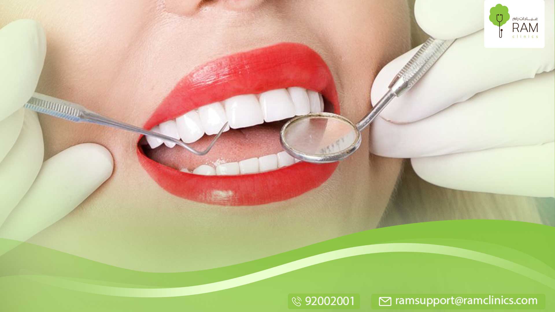 قشور الأسنان