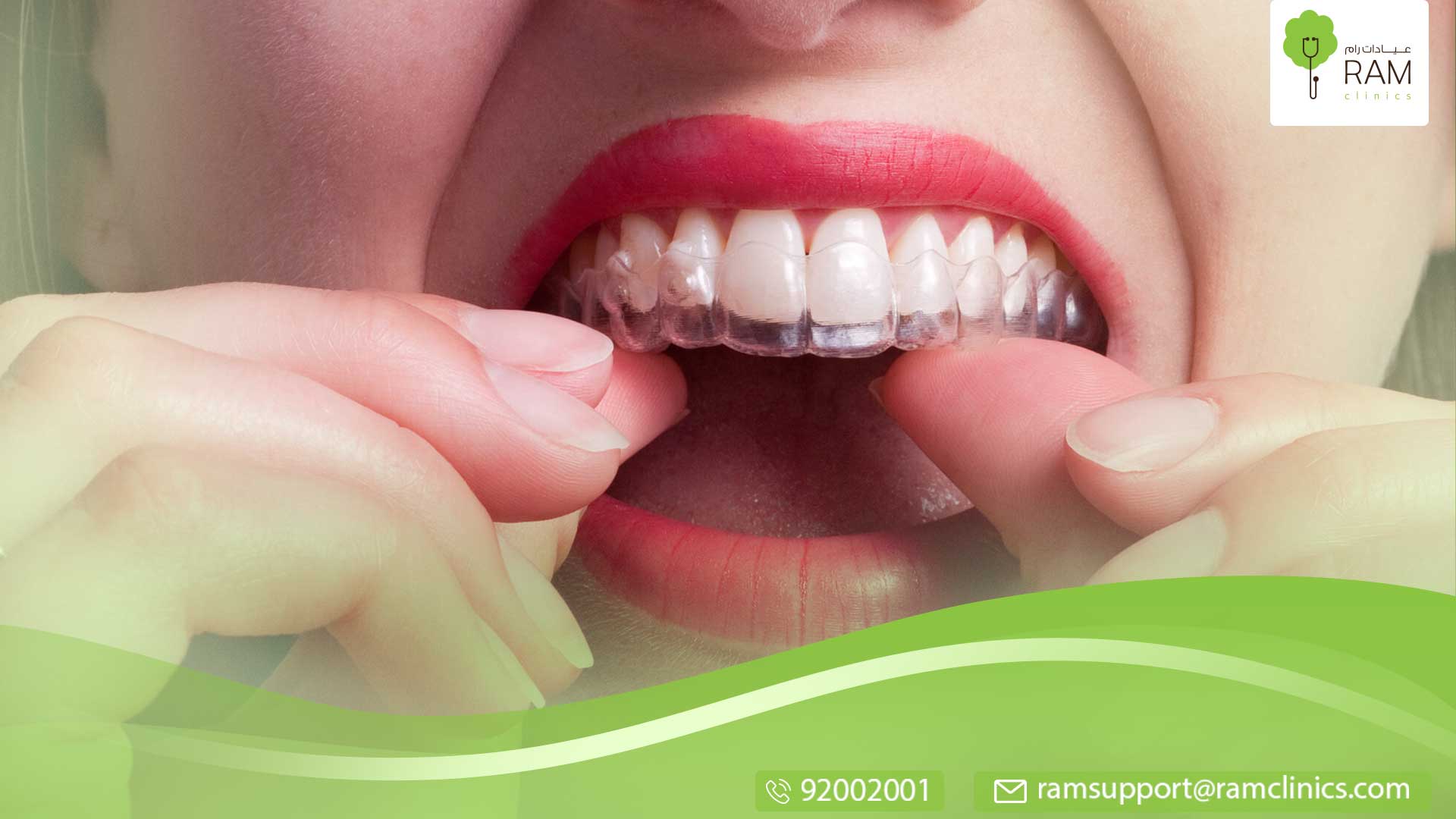 الحشوات التجميلية