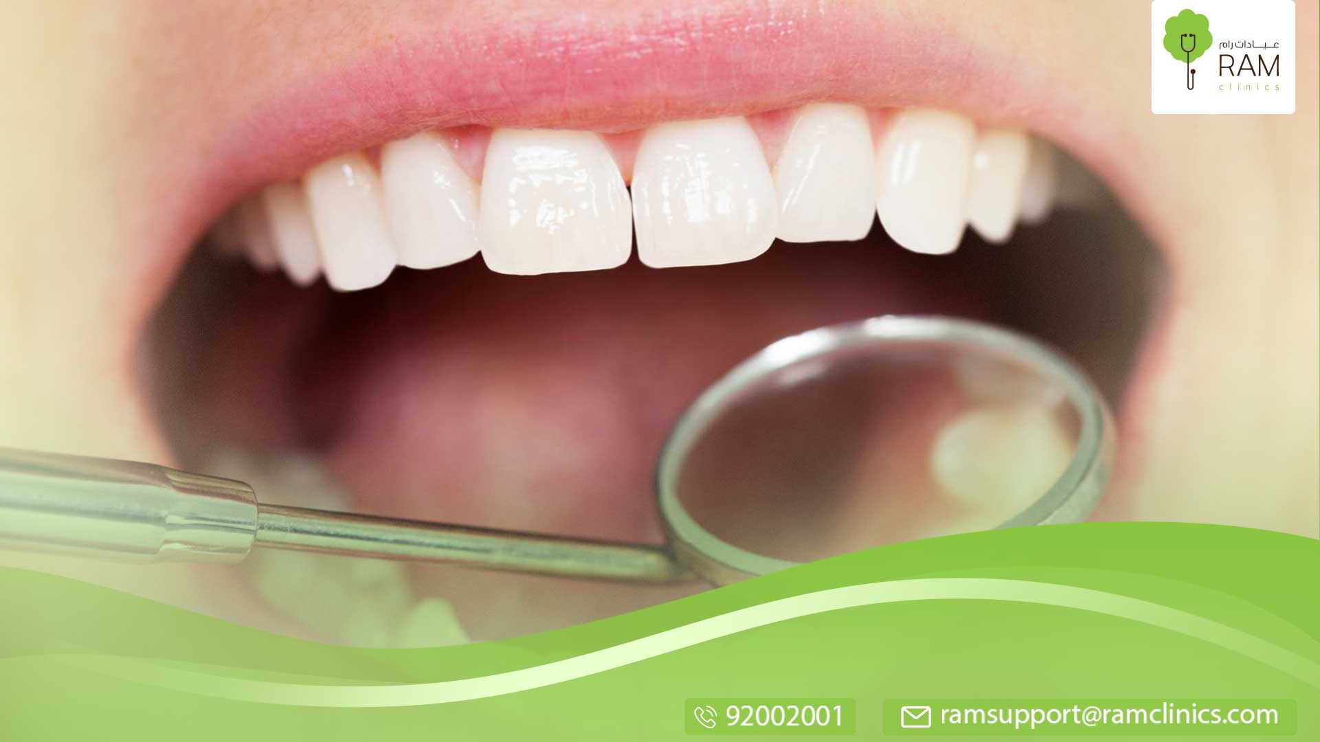 مساحات بين الأسنان