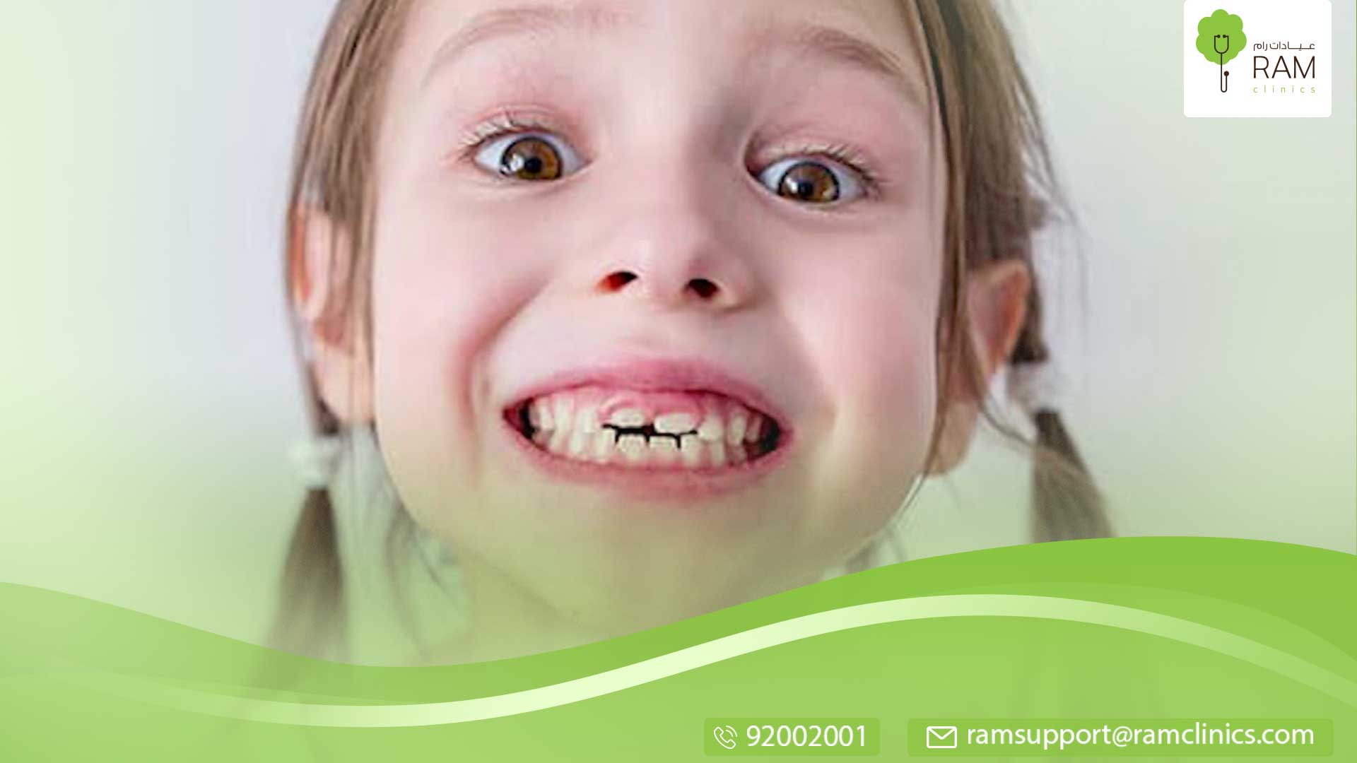 أسنان الأطفال الدائمة