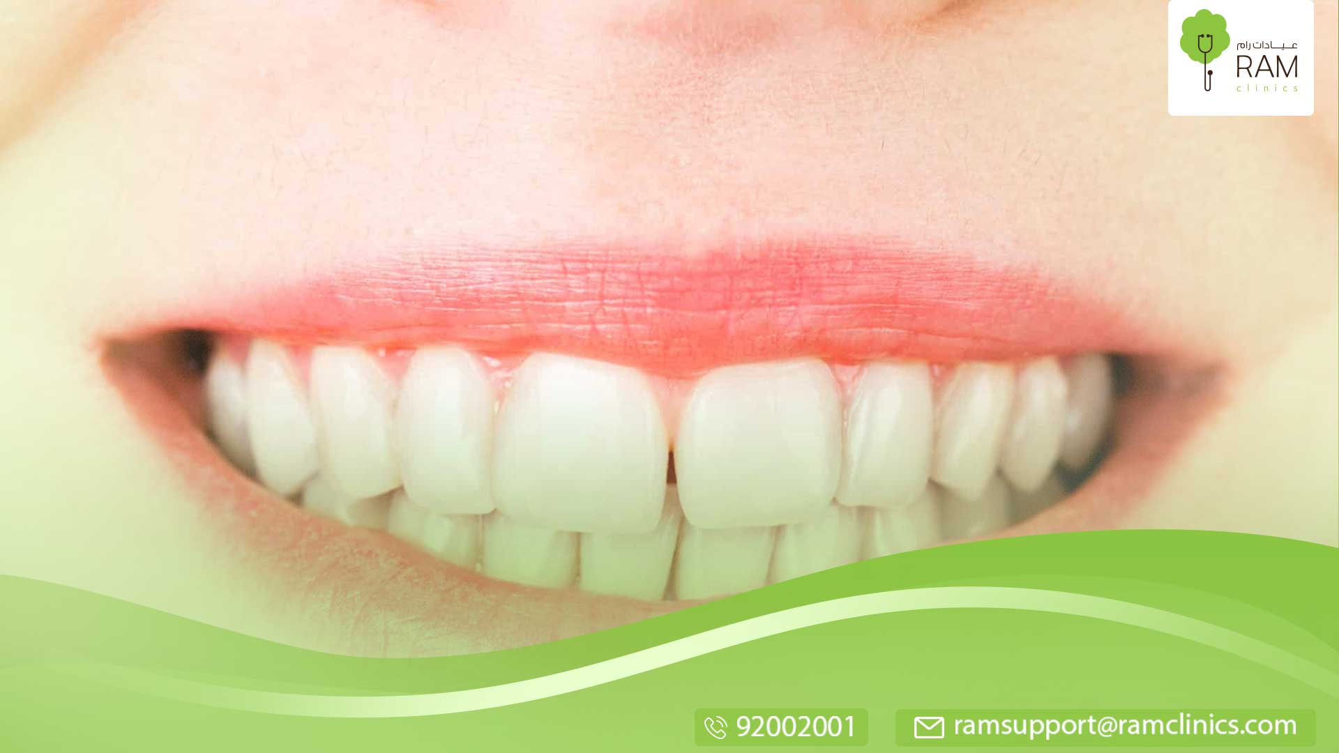 عدد أسنان اللبنية