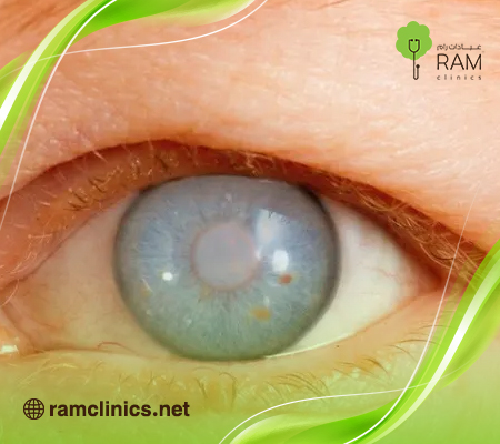 عملية المياه الزرقاء