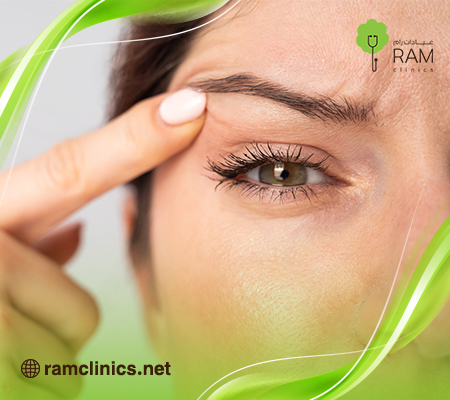 عملية-شد-الجفن