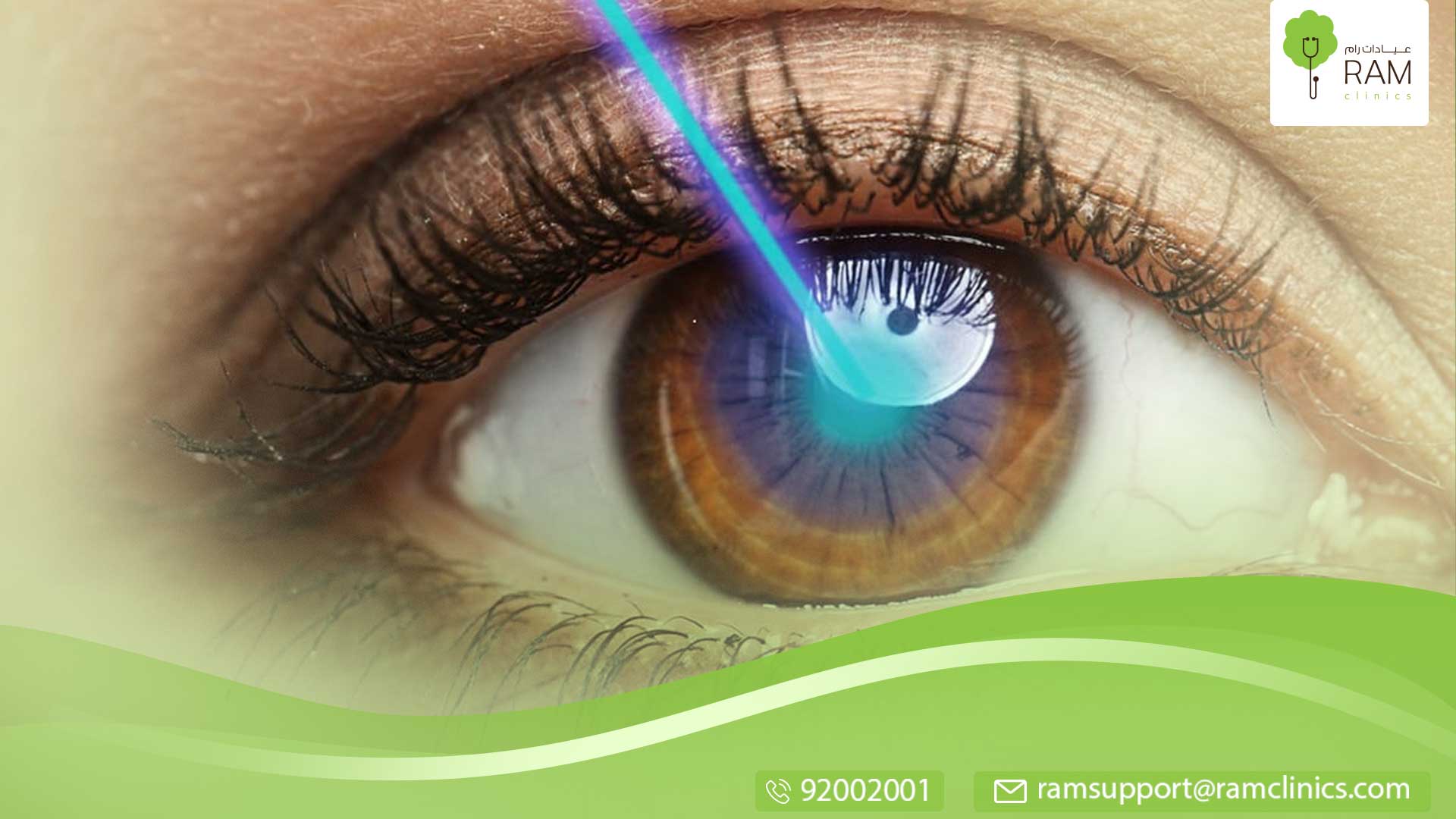 الليزر و الليزك