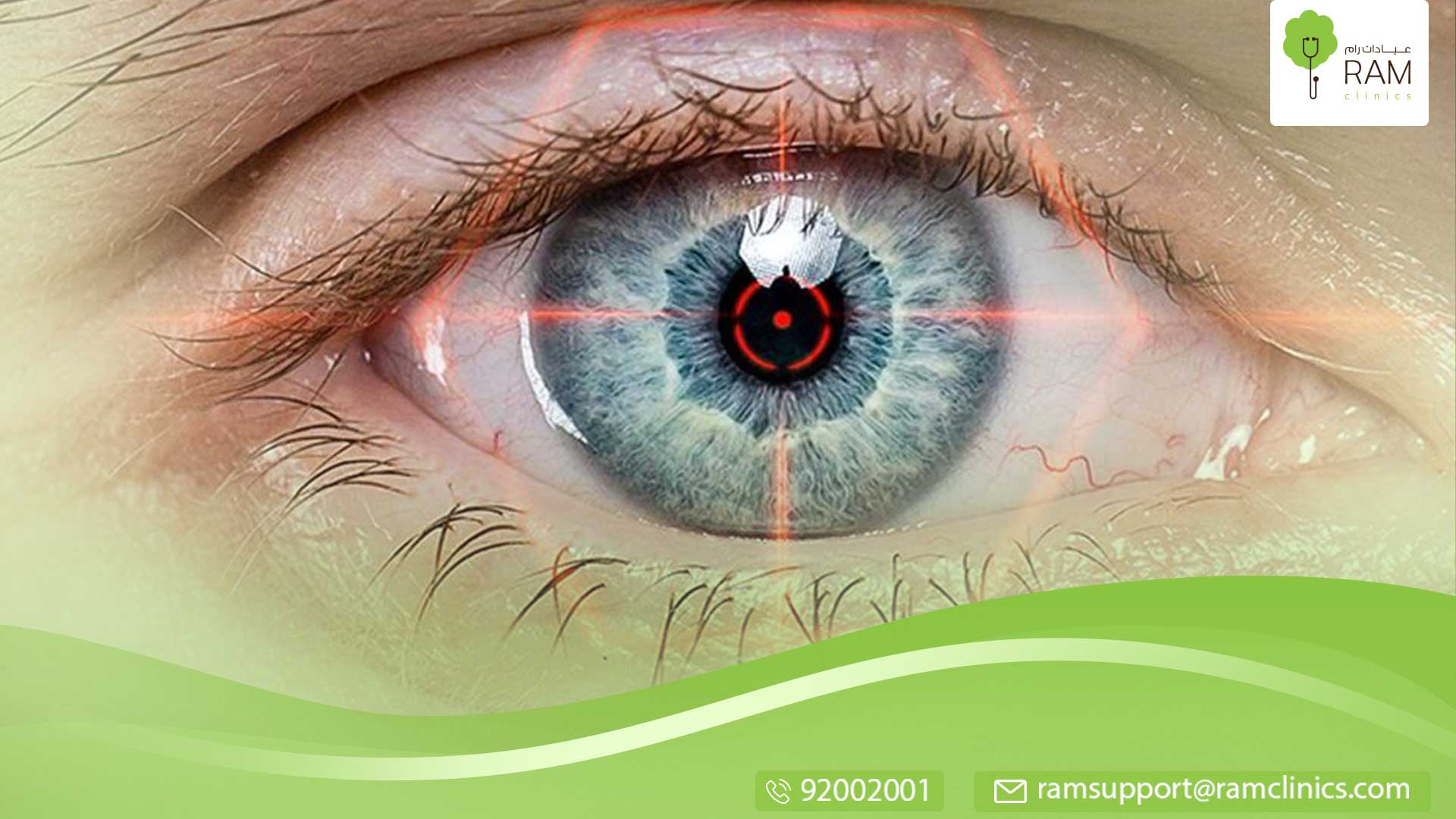 انسداد القنوات الدمعية